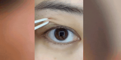 Rejuvenece tu mirada de manera instantánea y segura.